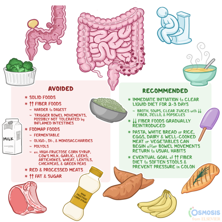 Printable List of Foods to Avoid with Diverticulitis